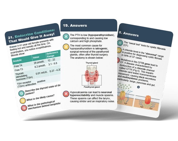 game cards